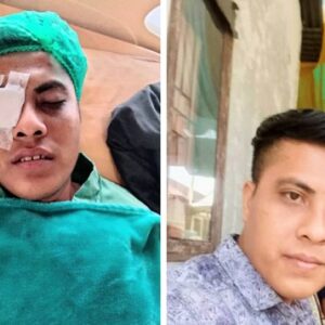 Pelaku Penganiayaan Hingga Butakan Mata Korban Sudah di Tahan Polsek Sunggal